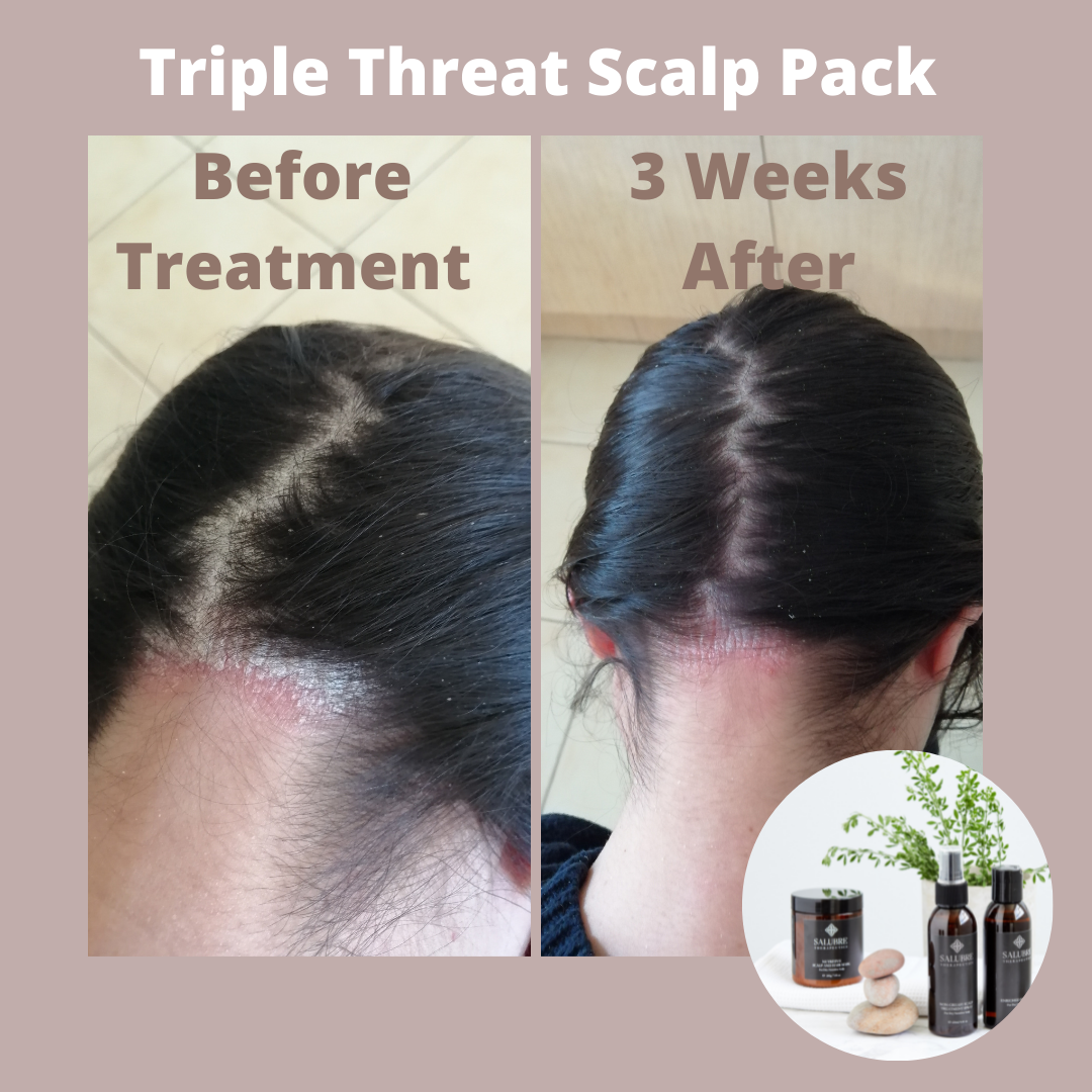 Triple Threat Scalp Care Pack