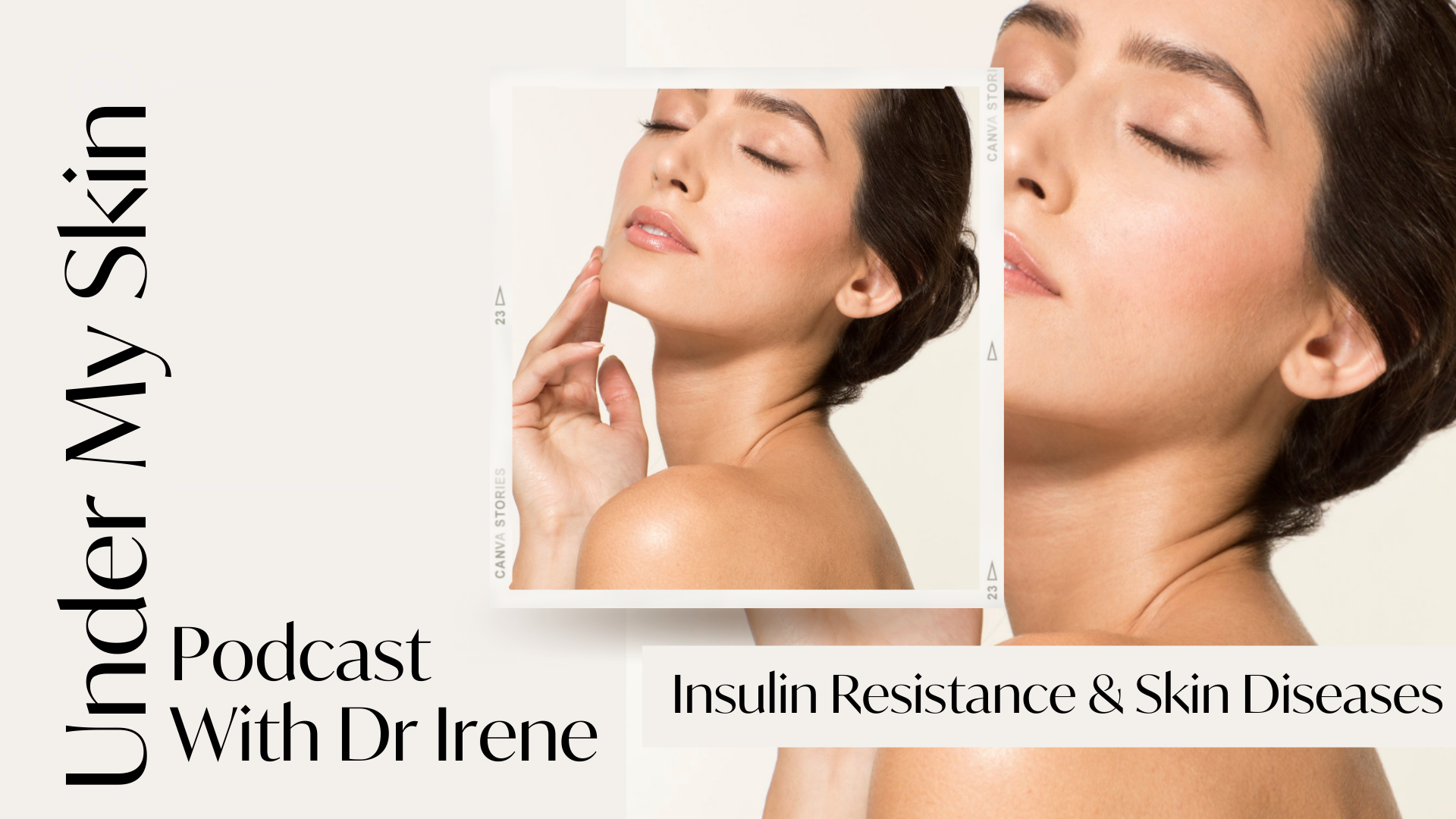 Under My Skin Podcast: Insulin Resistance & Skin Diseases
