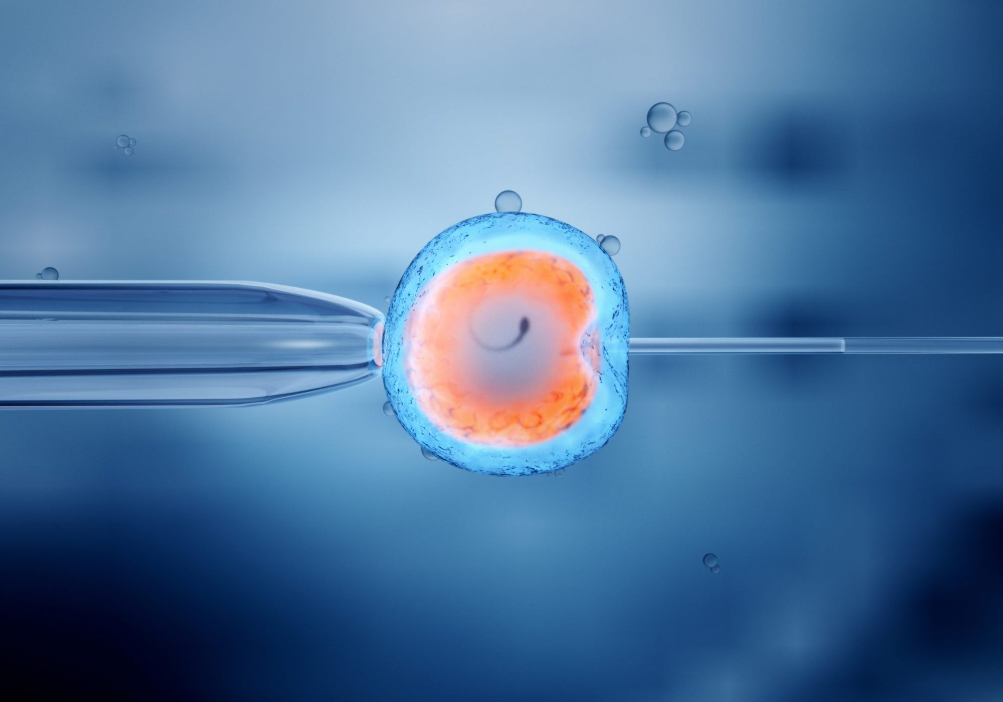 IVF: is it a fast track to pregnancy?