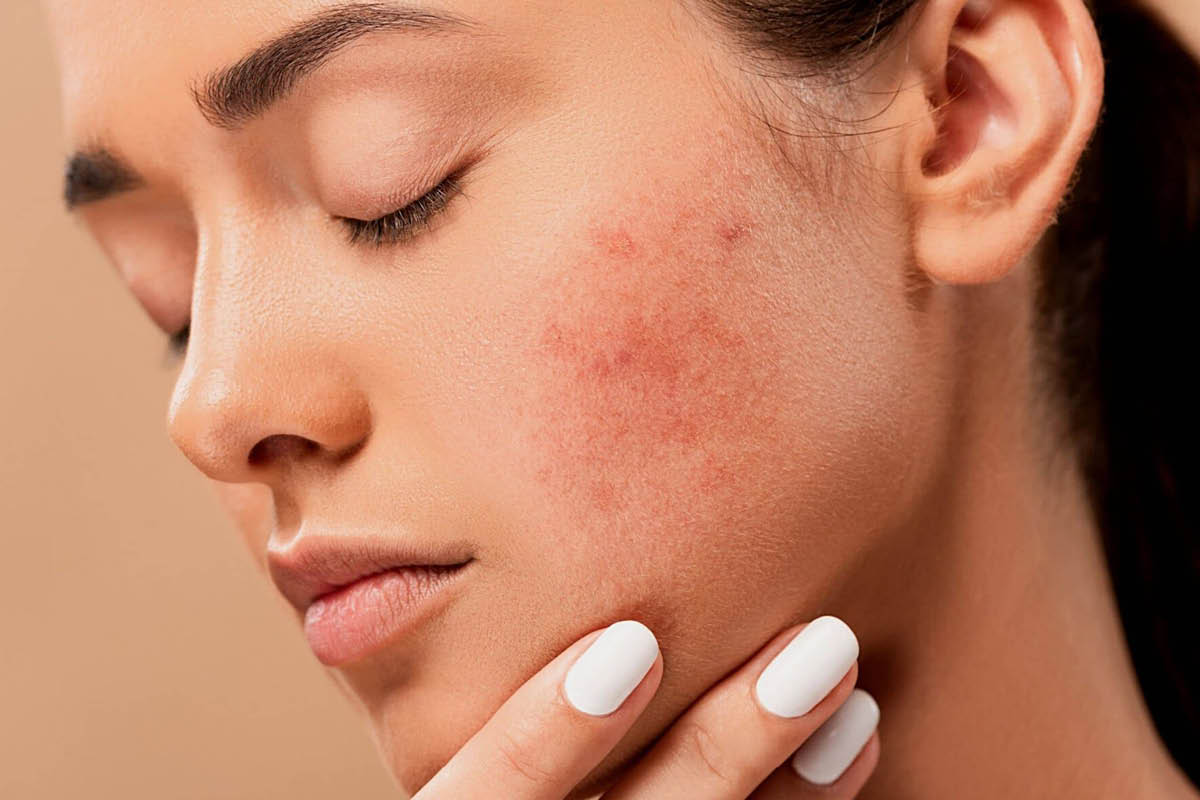 Best skincare for sensitive skin