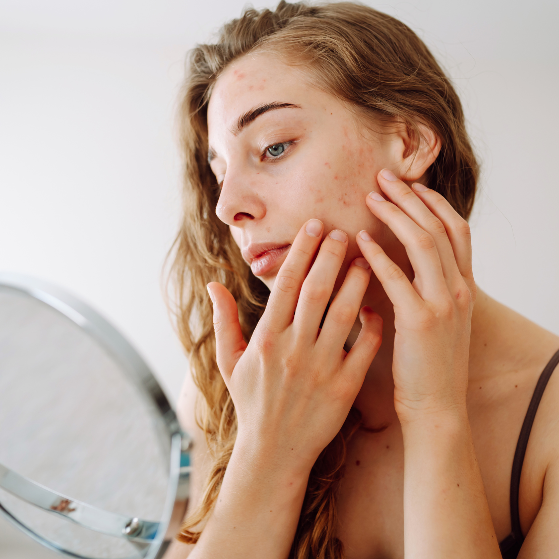 Sensitive Skin Treatment Guide: Diet, Inflammation Support & Skincare for Sensitive Skin with Salubre Cosmeceuticals