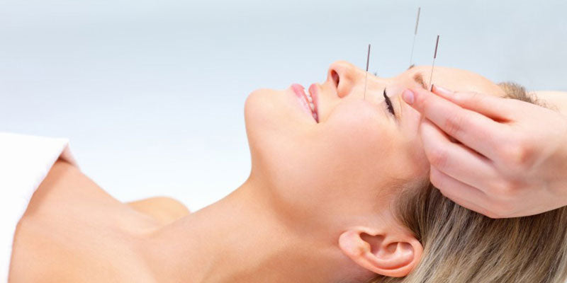 IVF Acupuncture