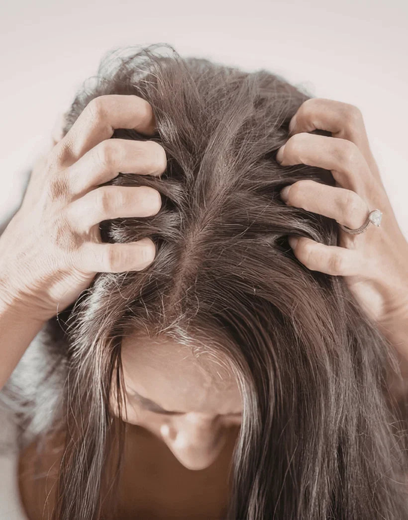 Scalp Conditions