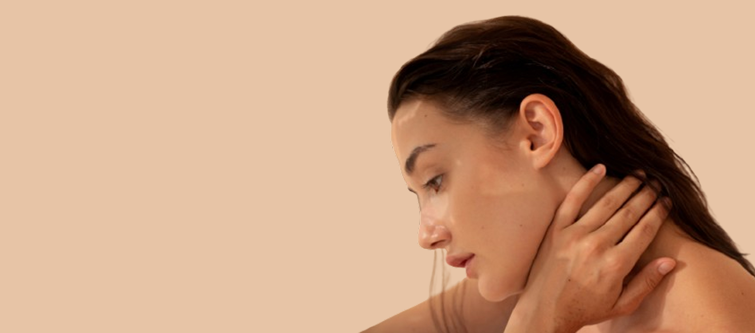 Eczema
