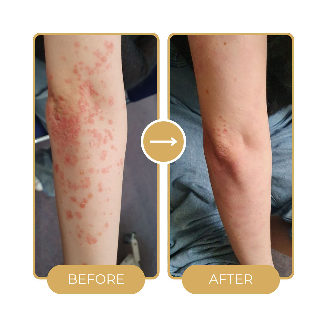 “8-Week Skin Reset Journey Online Program”