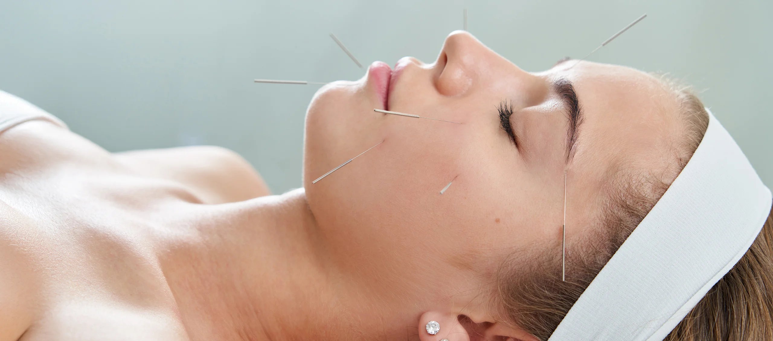 Cosmetic Acupuncture