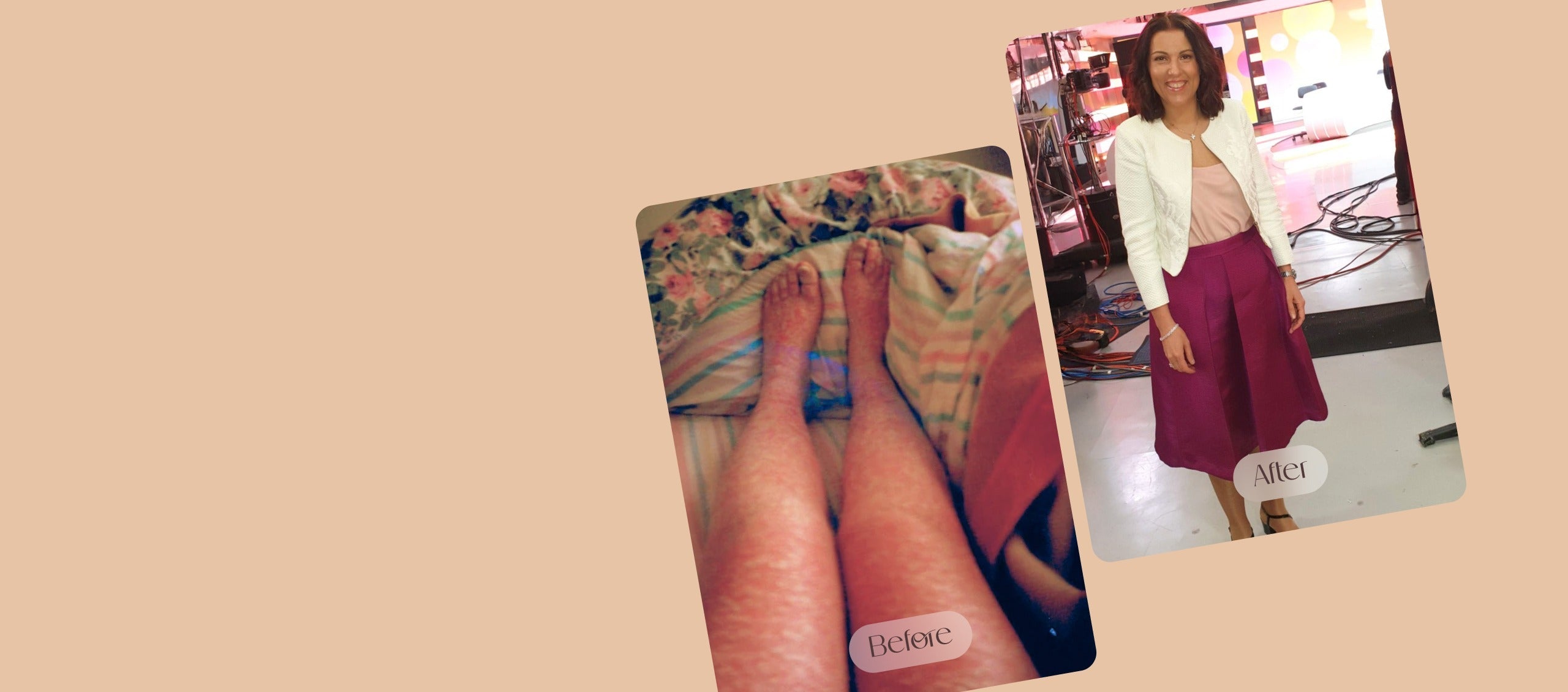 Dr Irene's Skin Story