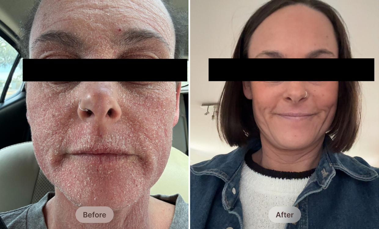 Before After Image