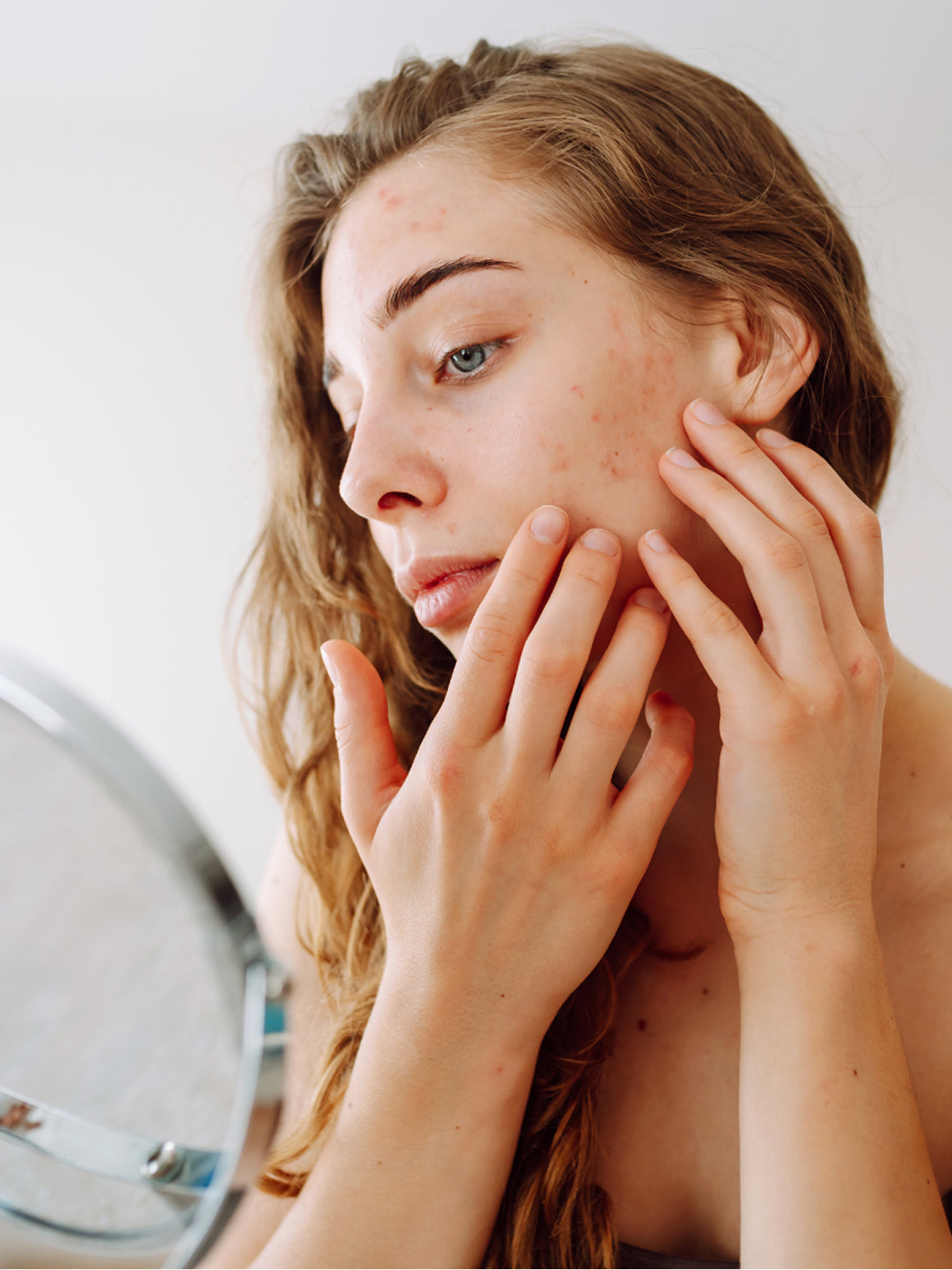 Healing Beyond Psoriasis