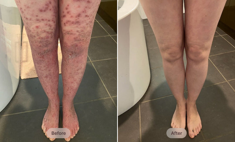 Before After Image 1 