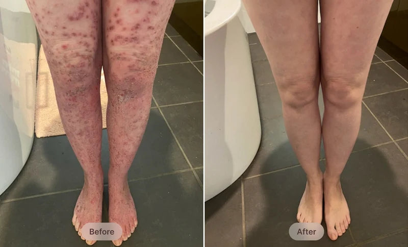 Before After Image