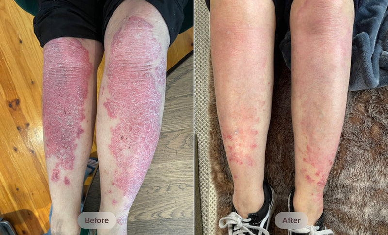 Before After Image 2