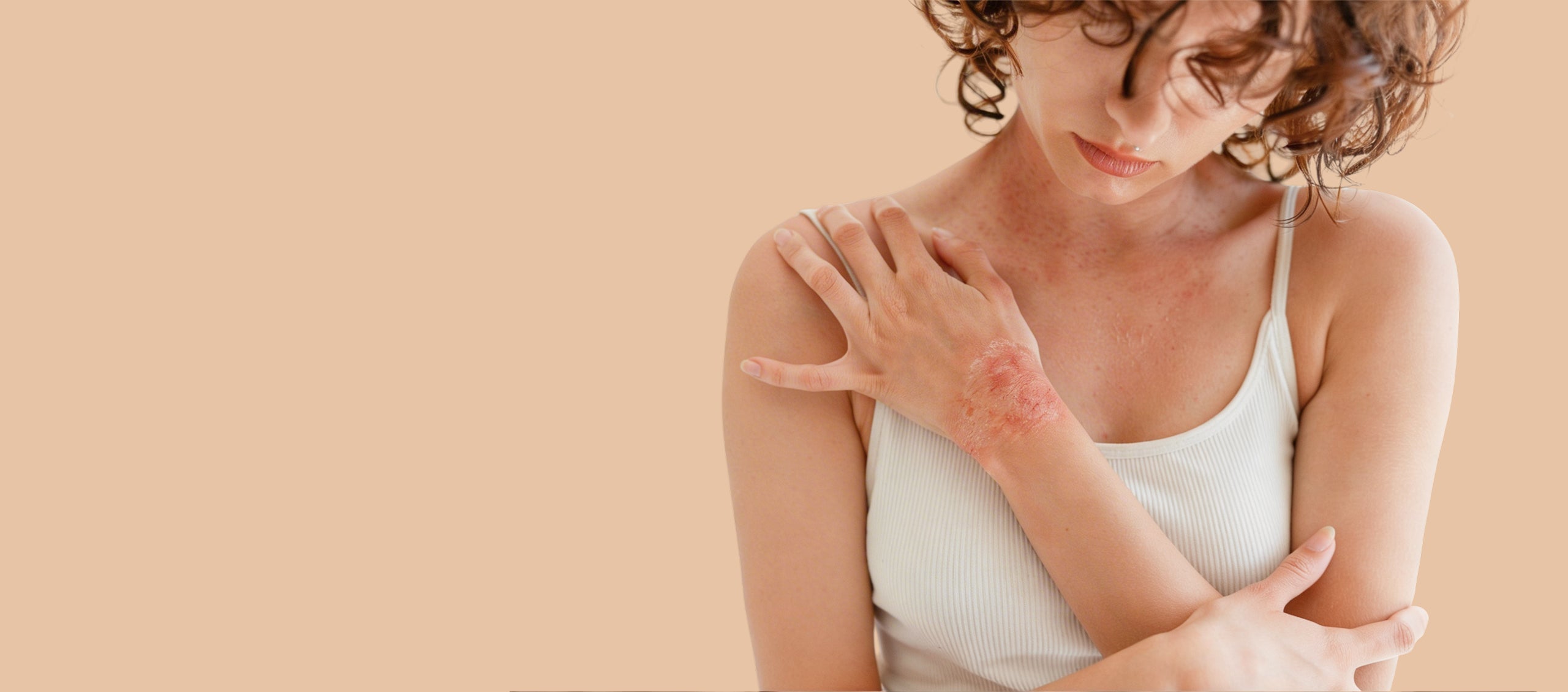 Psoriasis-FAQ_s-banner