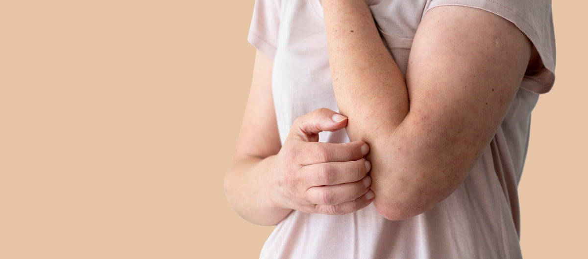 Psoriasis & Eczema Treatment