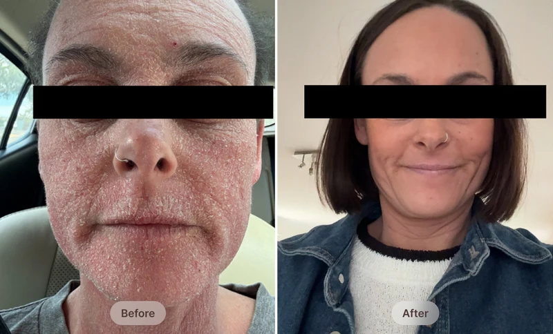 Before After Image