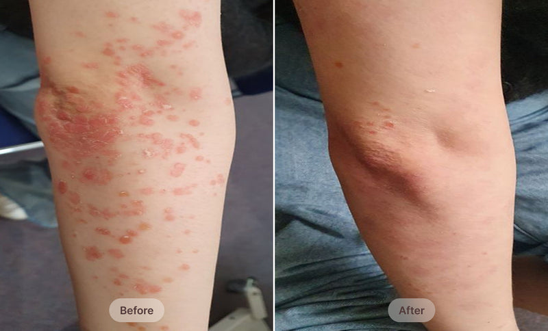 Before After Image