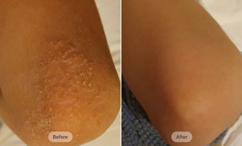 Before After Image