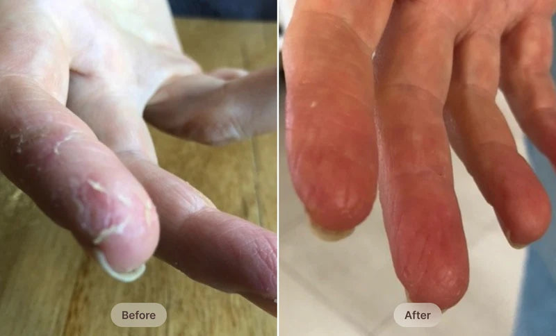 Before After Image