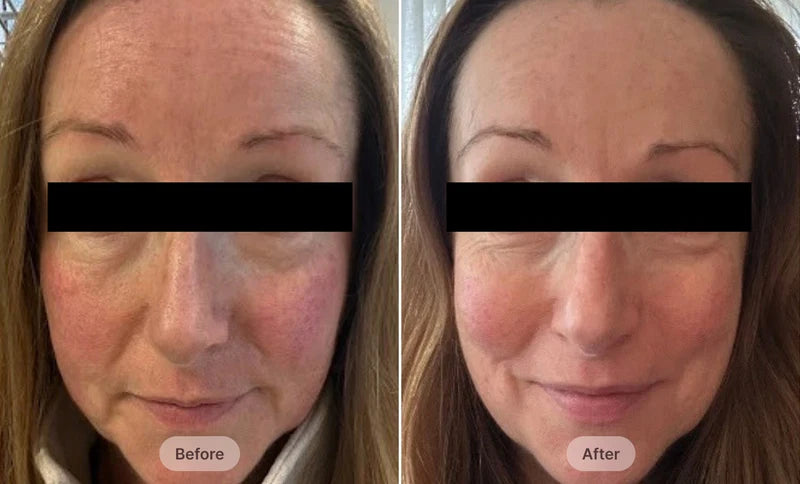 Before After Image