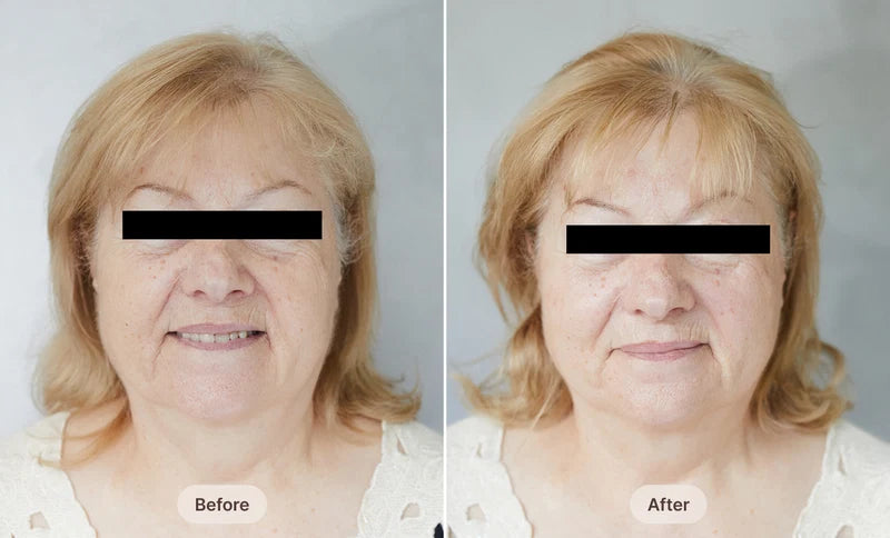 Before After Image
