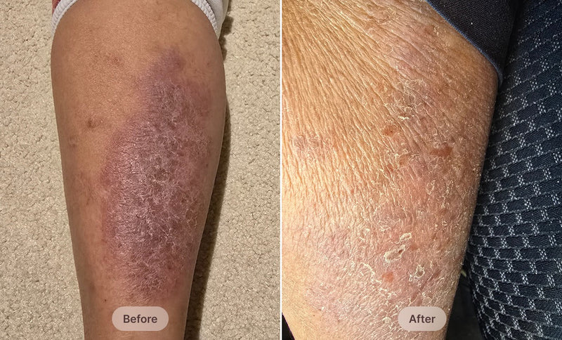 Before After Image