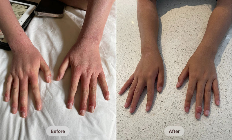 Before After Image