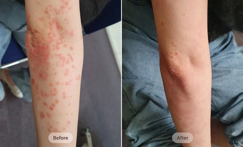 Before After Image