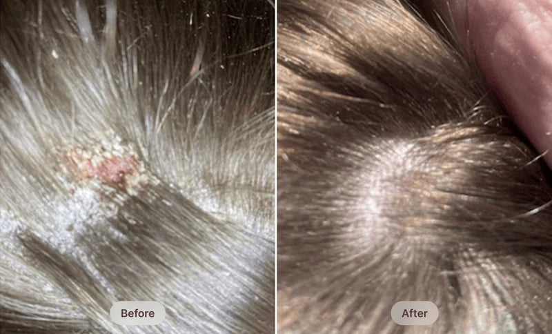Before After Image