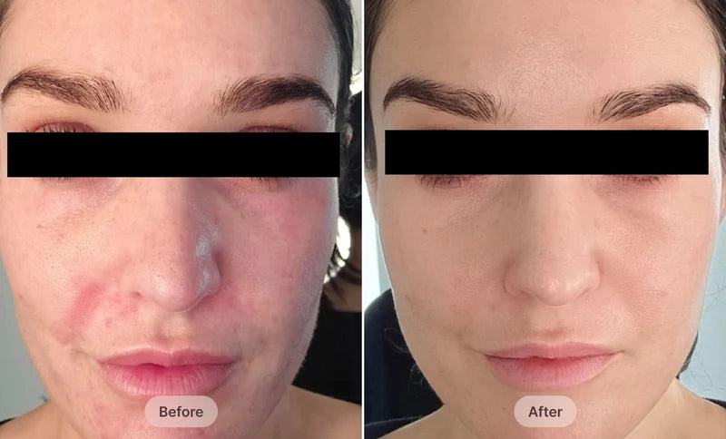 Before After Image
