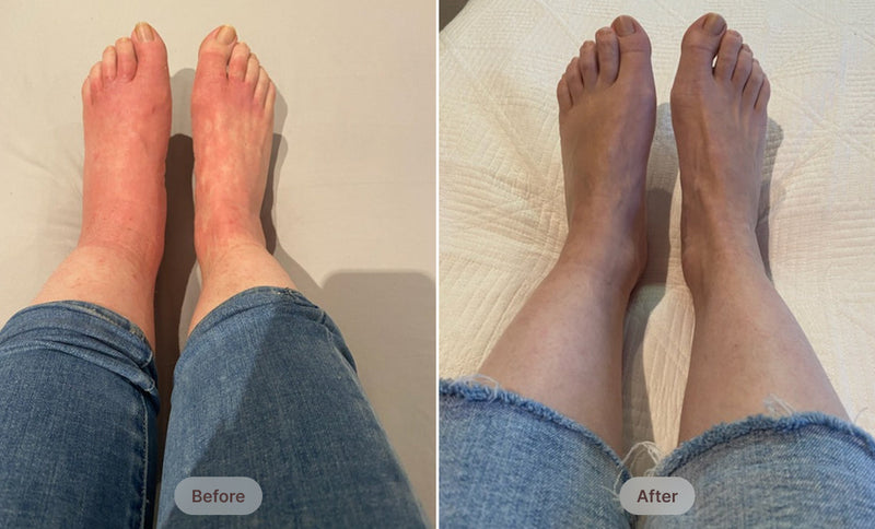 Before After Image