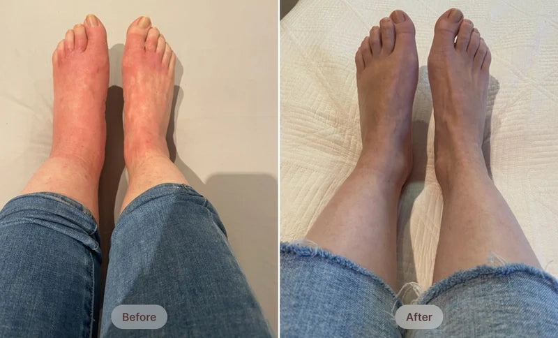 Before After Image