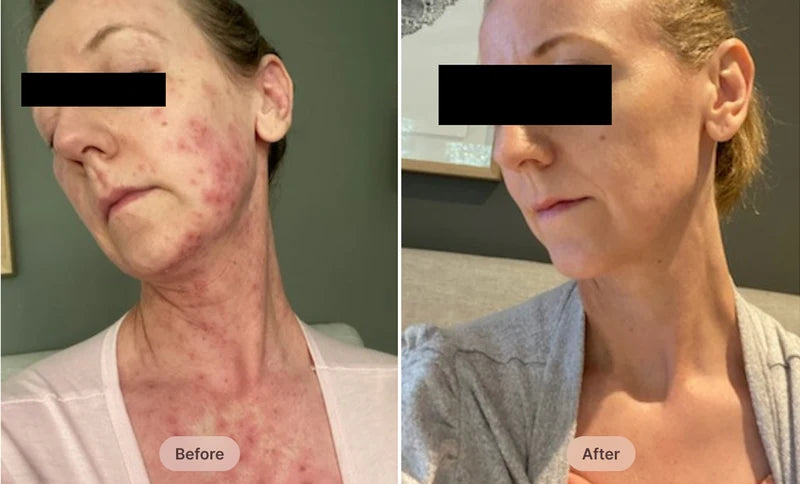Before After Image