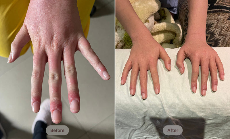 Before After Image