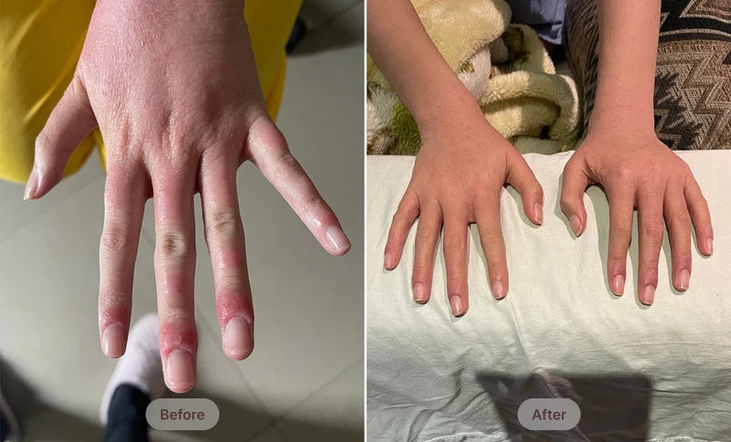 Before After Image