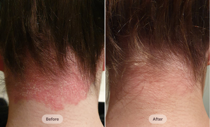 Before After Image