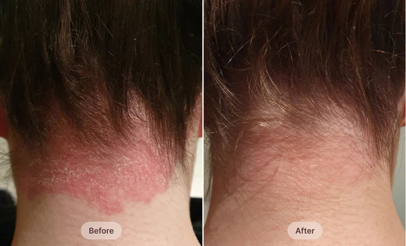 Before After Image