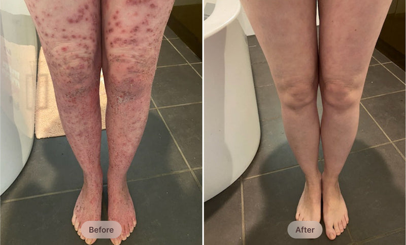 before-after