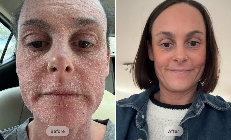 before-after