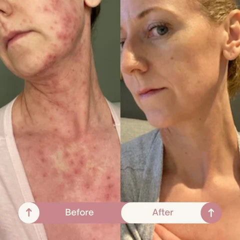 before-and-after-kelly