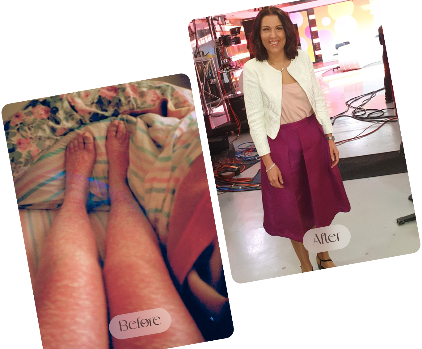 dr-irene's-skin-story