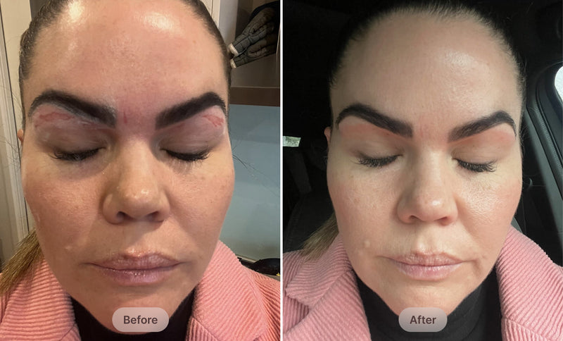 before-after
