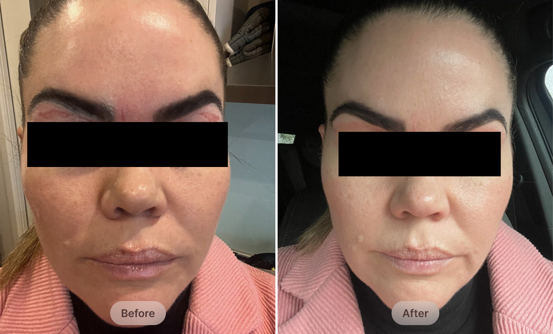 Before After Image