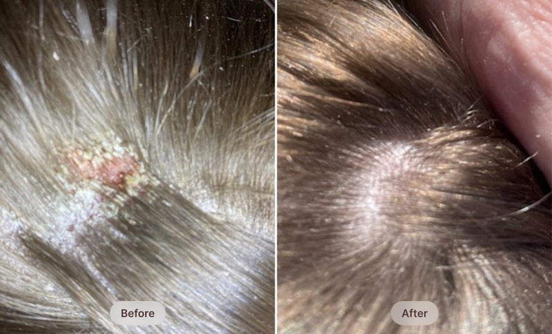 before-after