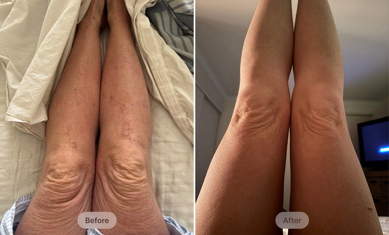before-after