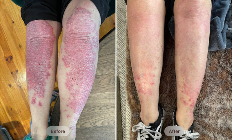 before-after