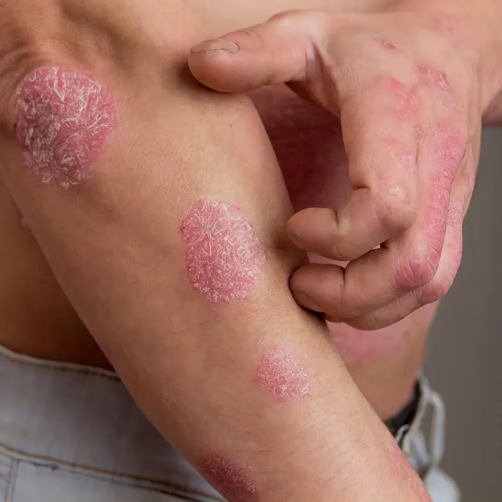 support-skin-health