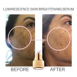 Luminescence Skin Brightening Serum Before and After use.