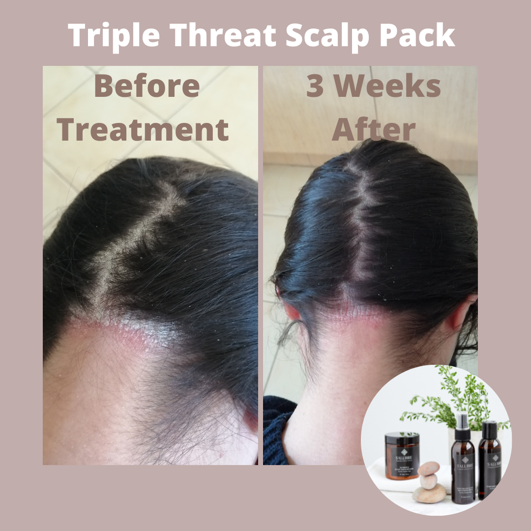 Triple Threat Scalp Pack + Free Luminosi-tea